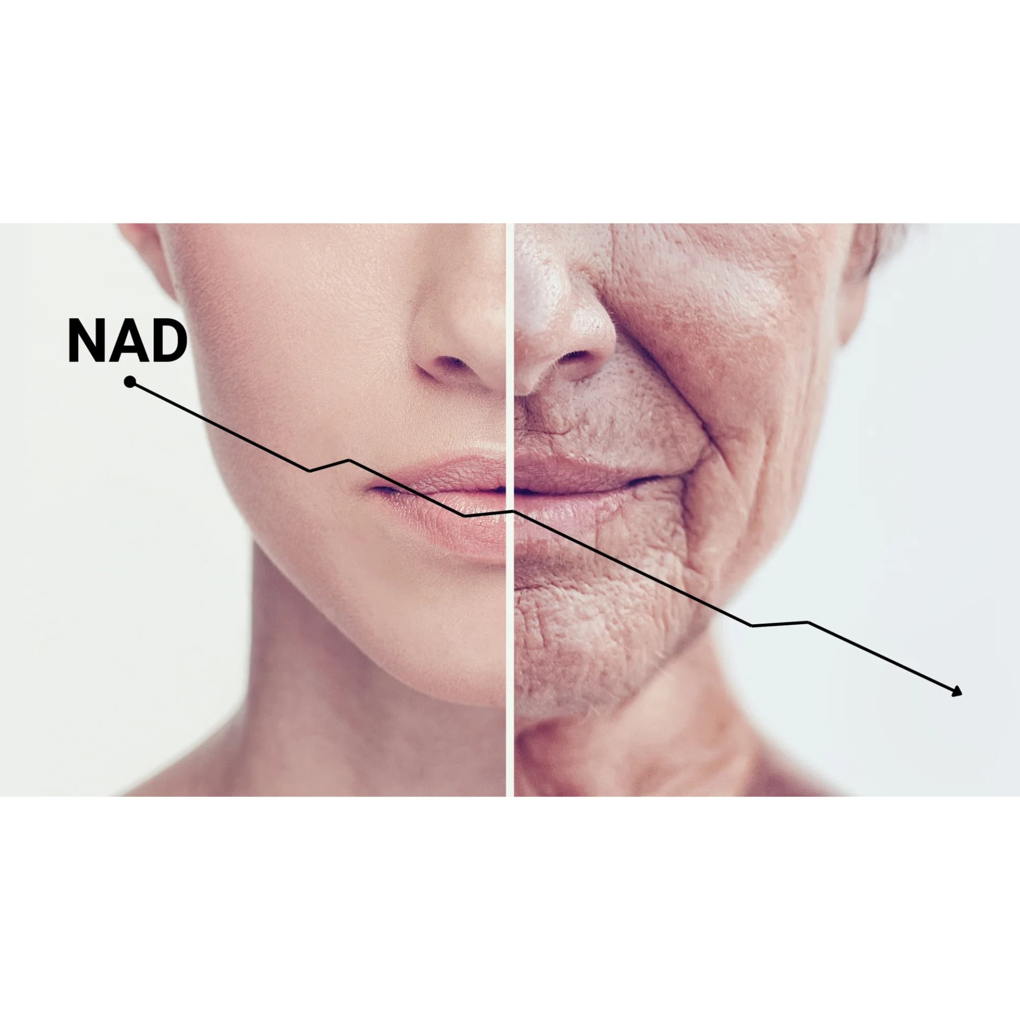 NAD+ буурна